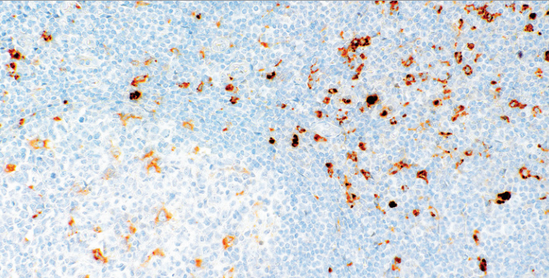 Lysozyme Rabbit Monoclonal Antibody(ARM520)