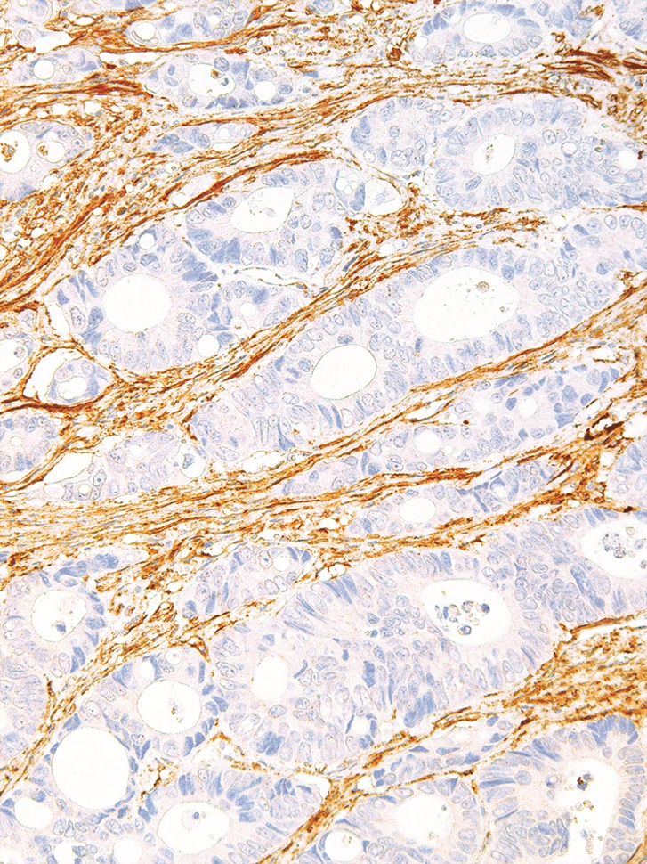 Fibronectin Mouse Monoclonal Antibody(ARM991)