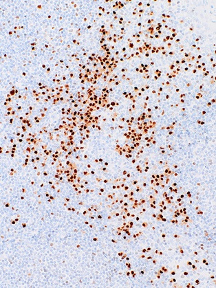 MUM1 Mouse Monoclonal Antibody(ARM530)