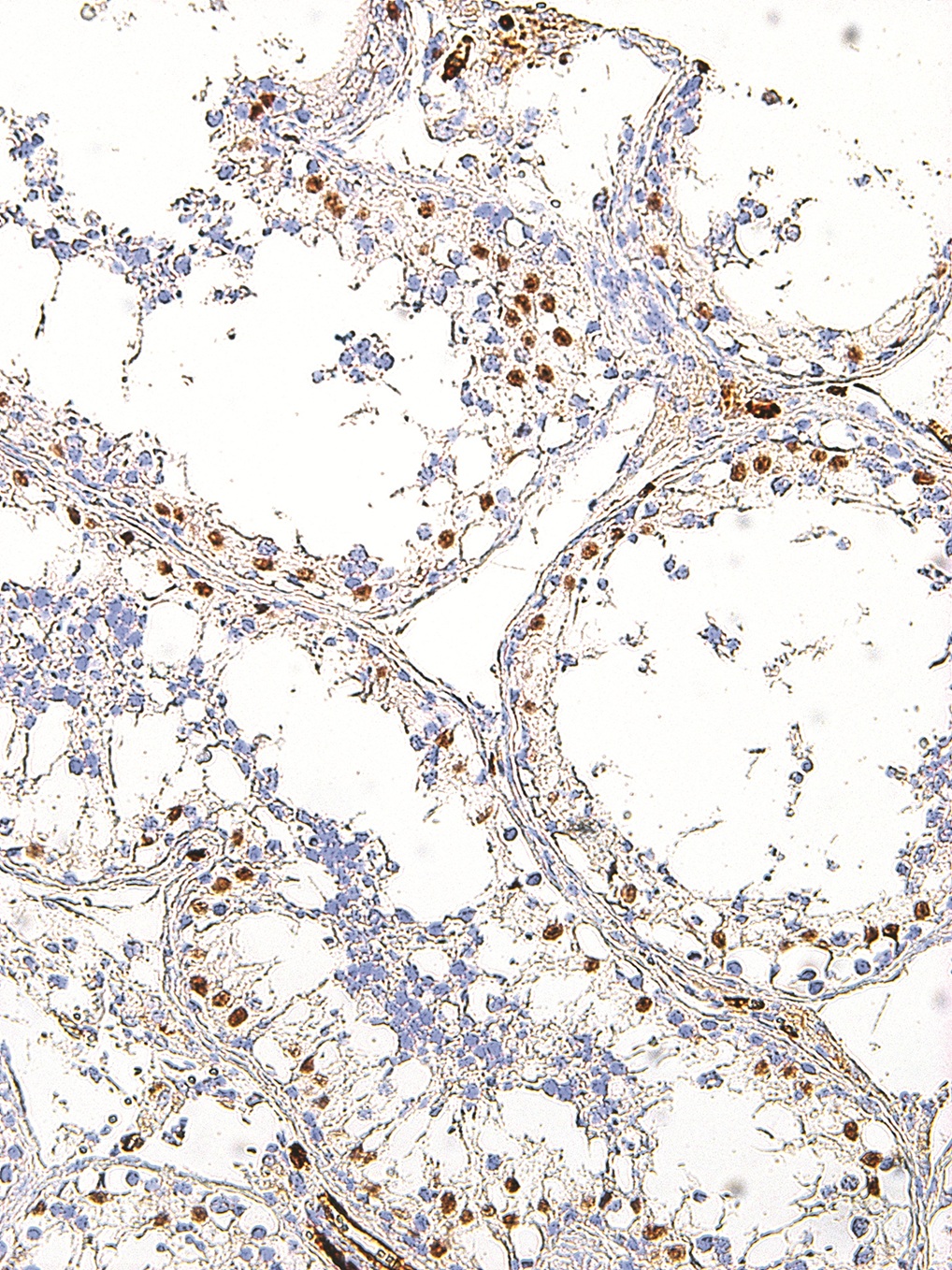 WT1 Mouse Monoclonal Antibody(ARM586)