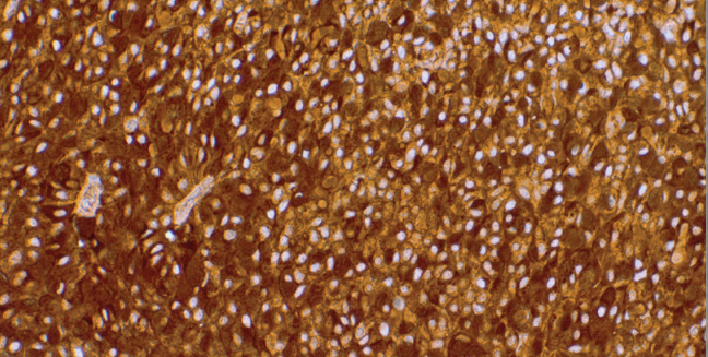 GCDFP-15 Rabbit Monoclonal Antibody(ARM996)