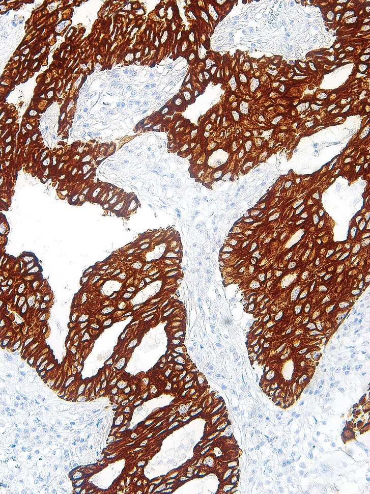 Cytokeratin 7 Mouse Monoclonal Antibody(ARM978)