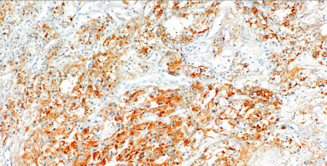 RCC Mouse Monoclonal Antibody(ARM559)