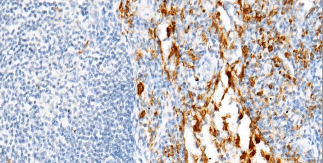 Granzyme B Mouse Monoclonal Antibody(ARM501)