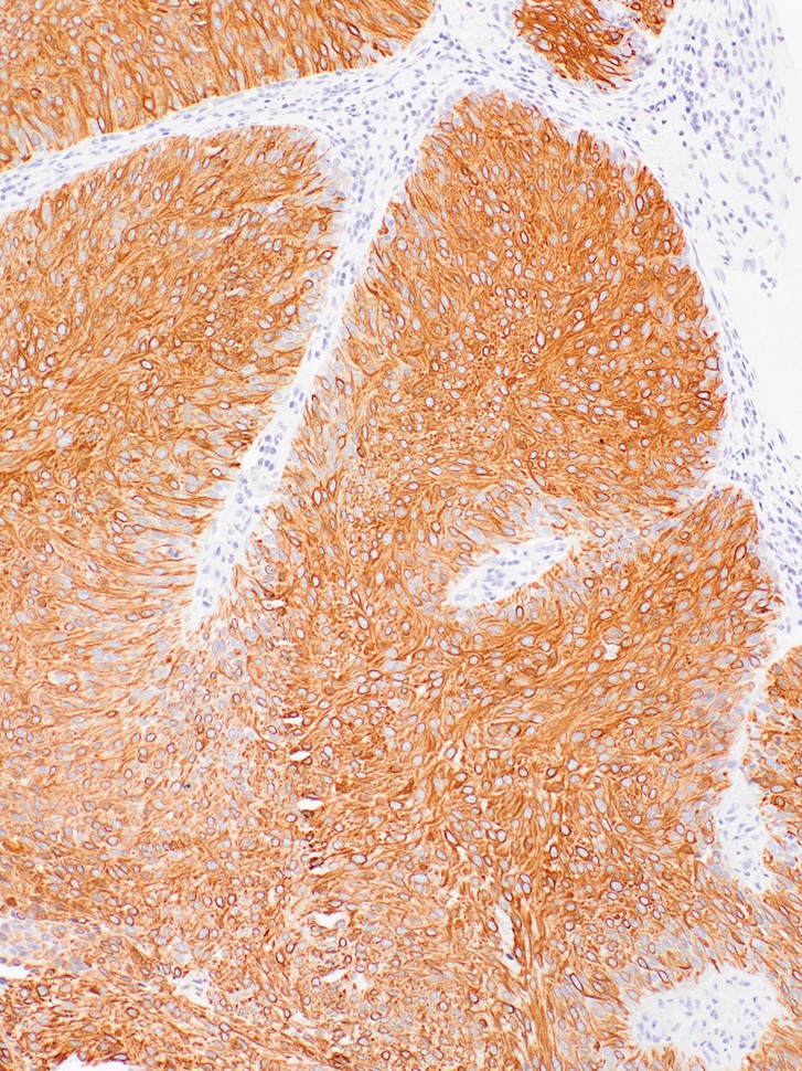 Cytokeratin 20 Rabbit Monoclonal Antibody(ARM977)