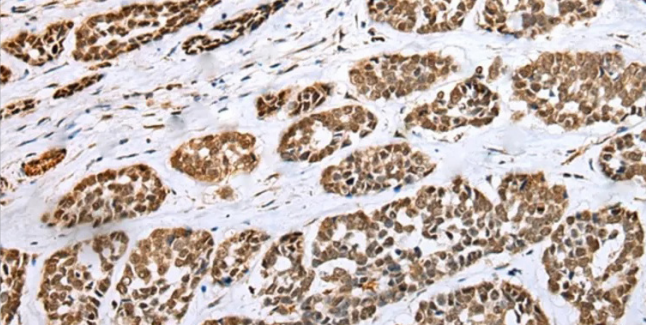 HIF-1 Alpha Rabbit Monoclonal Antibody(ARM508)
