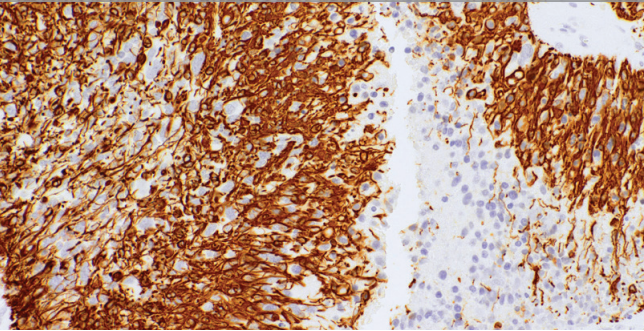 Glial Fibrillary Acidic Protein (GFAP) Rabbit Monoclonal Antibody(ARM997)