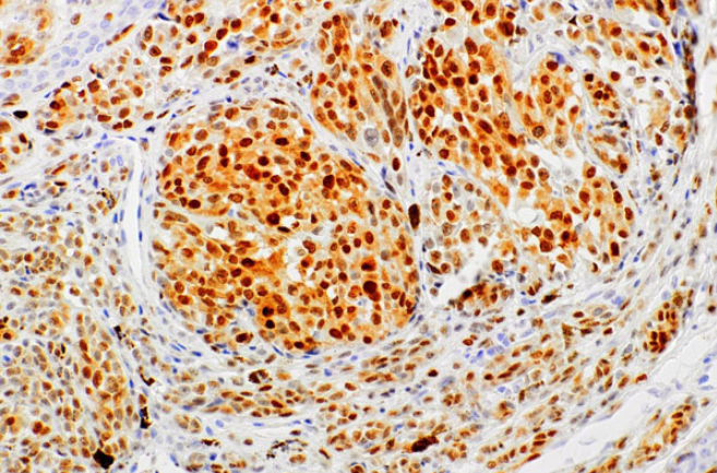 MiTF Mouse Monoclonal Antibody(ARM525)