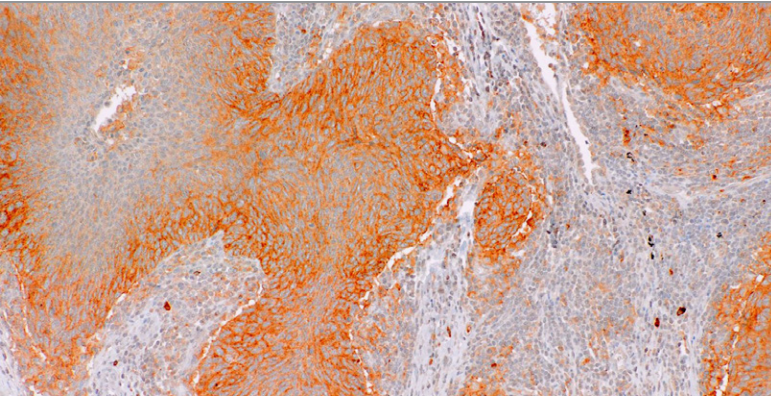PD-L1-IMF Rabbit Monoclonal Antibody(ARM550)