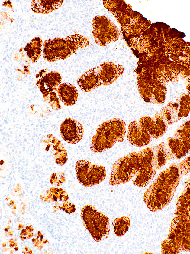 MUC5AC Mouse Monoclonal Antibody(ARM529)