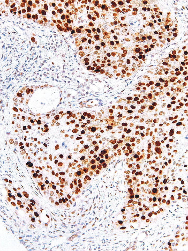 p53 Mouse Monoclonal Antibody(ARM544)