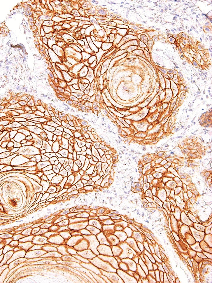 Desmoglein-3 Mouse Monoclonal Antibody(ARM982)