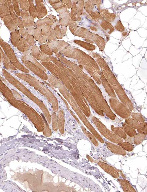 Myoglobin Rabbit Monoclonal Antibody(ARM533)