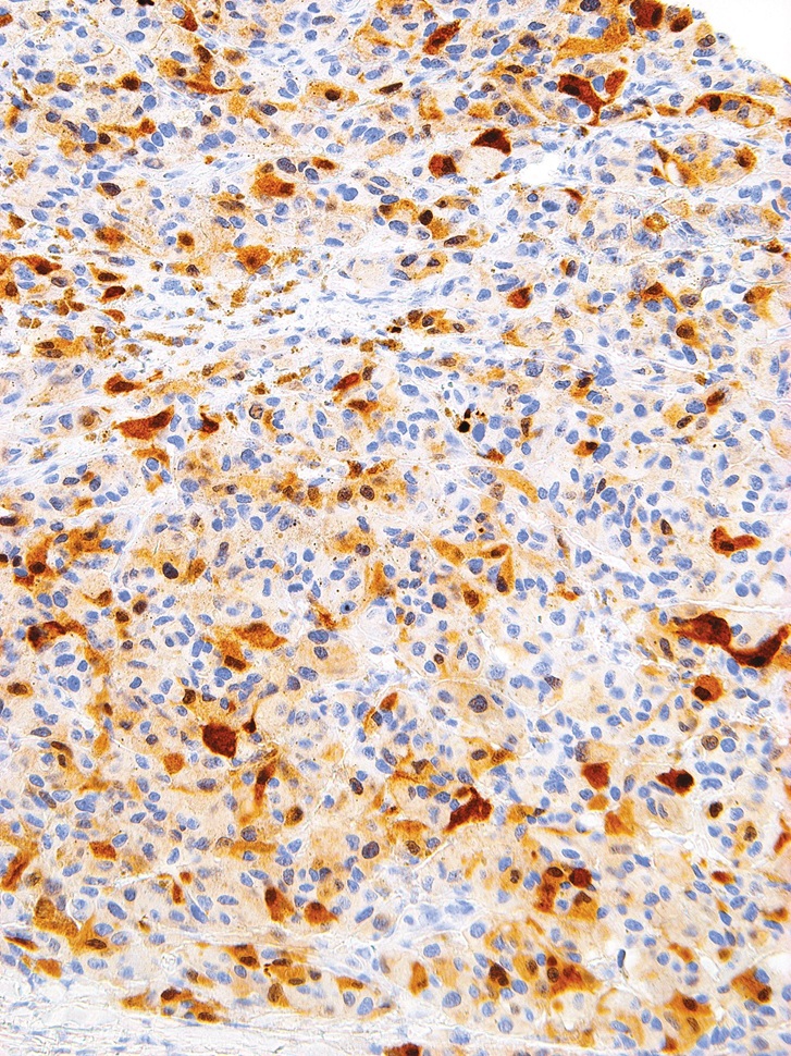 S-100 Mouse Monoclonal Antibody(ARM561)