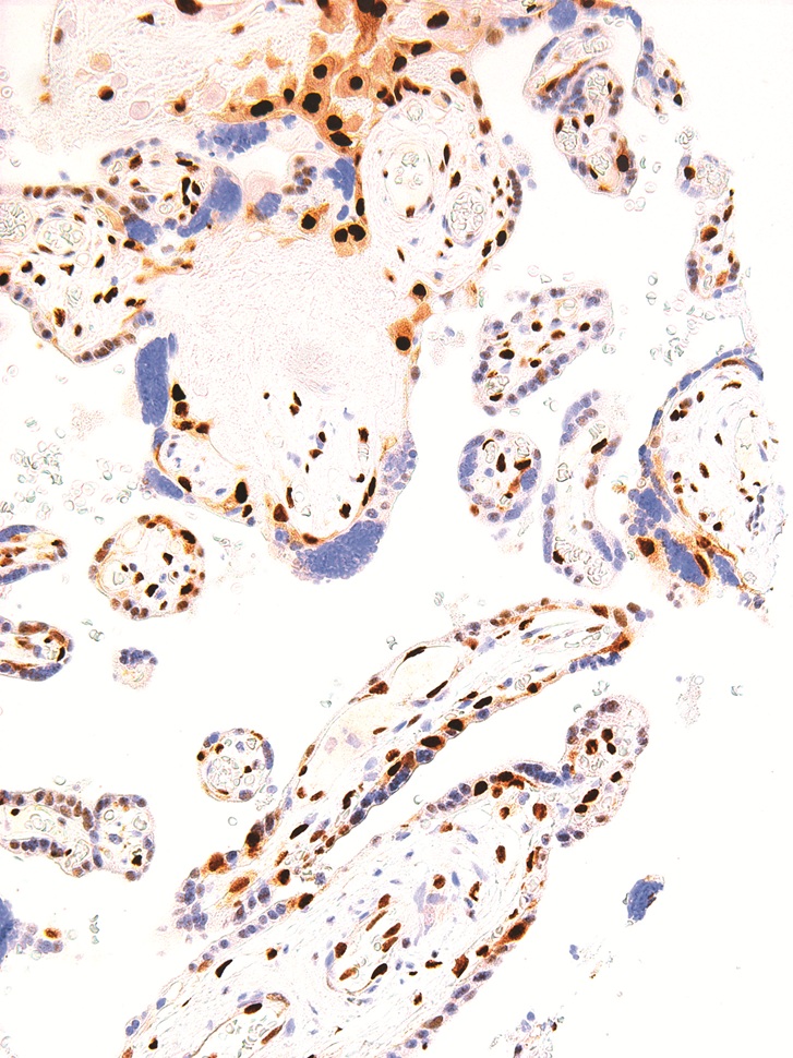 p57 kip2 Mouse Monoclonal Antibody(ARM545)