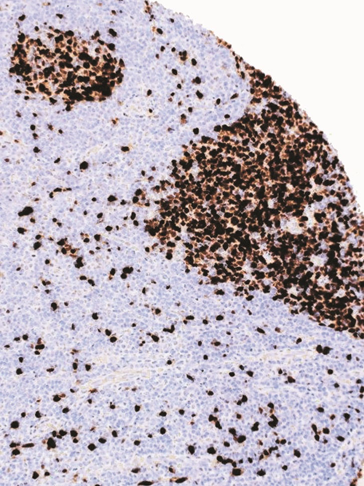 TOP2A Mouse Monoclonal Antibody(ARM581)