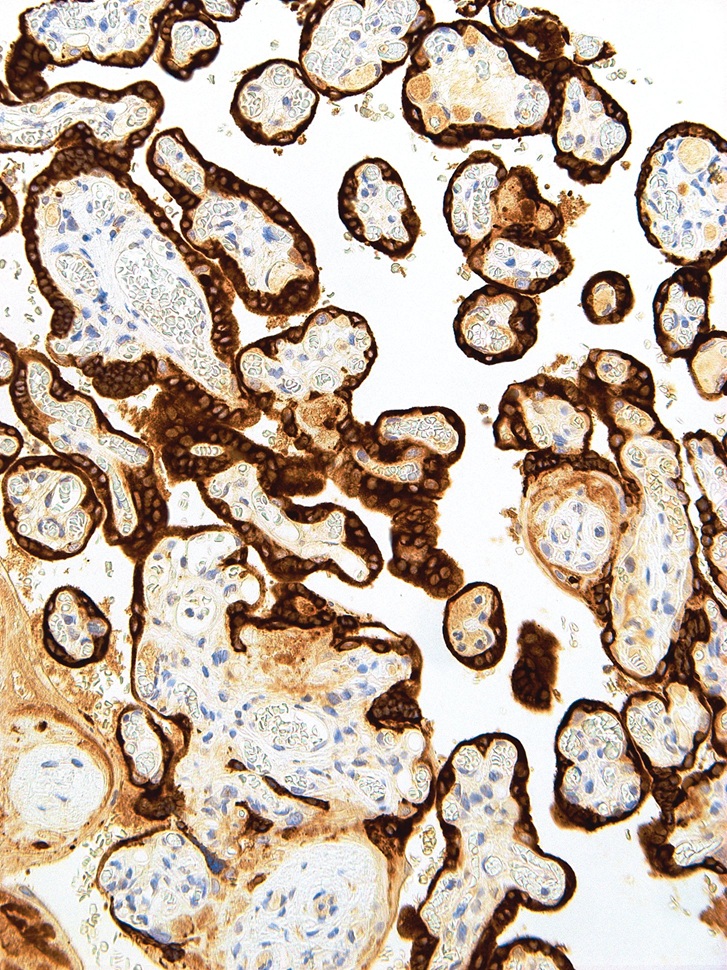 hCG Mouse Monoclonal Antibody(ARM505)