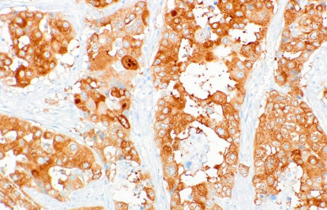 IMP3 Rabbit Monoclonal Antibody(ARM510)