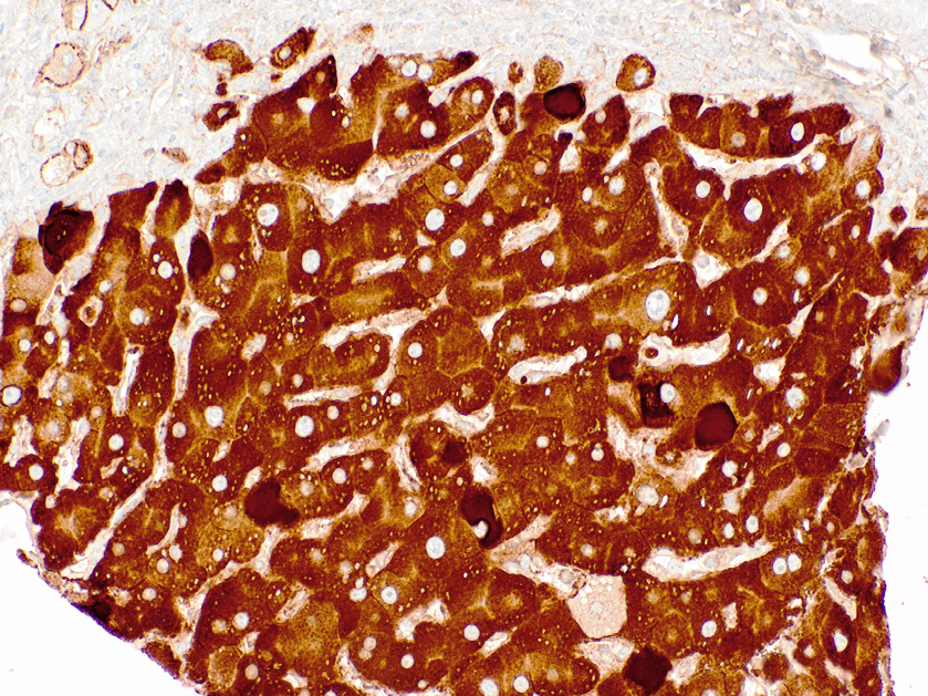 HBsAg Mouse Monoclonal Antibody(ARM504)
