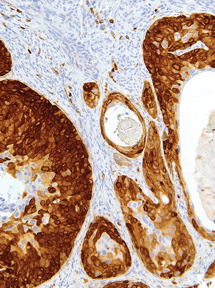 Stathmin Mouse Monoclonal Antibody(ARM570)