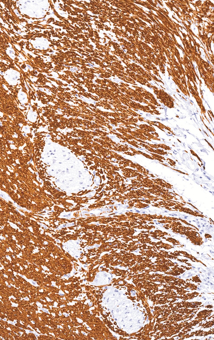 Desmin Mouse Monoclonal Antibody(ARM981)