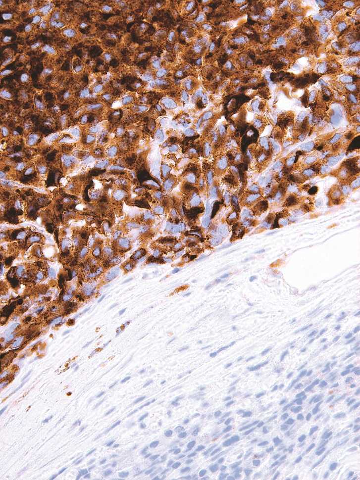 HMB-45 Mouse Monoclonal Antibody(ARM509)