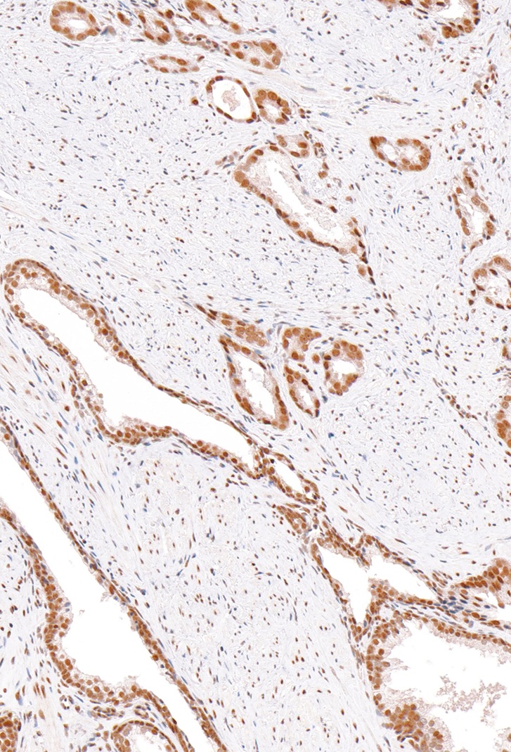 ERCC1 Mouse Monoclonal Antibody(ARM986)