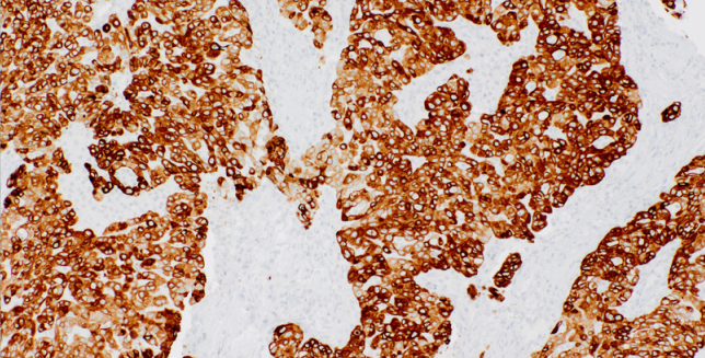 Cytokeratin 7/8 Mouse Monoclonal Antibody(ARM979)