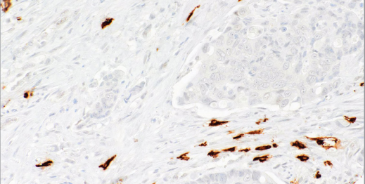 Tryptase Mouse Monoclonal Antibody(ARM582)