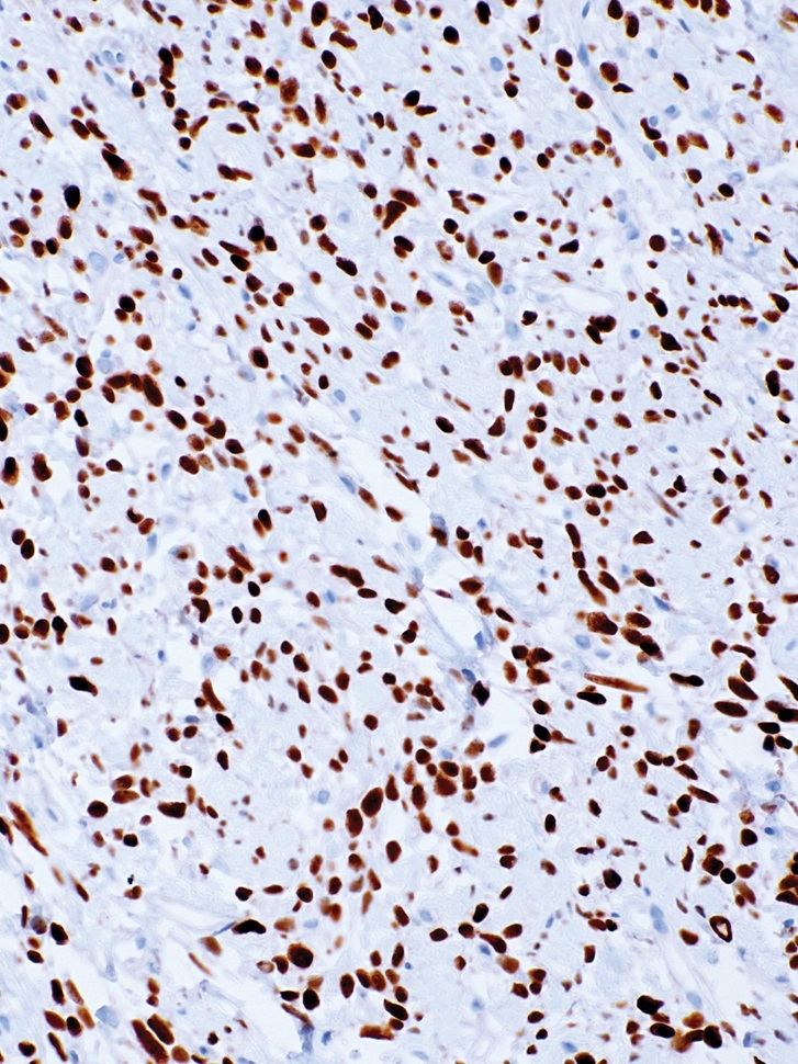 STAT6 Rabbit Monoclonal Antibody(ARM569)