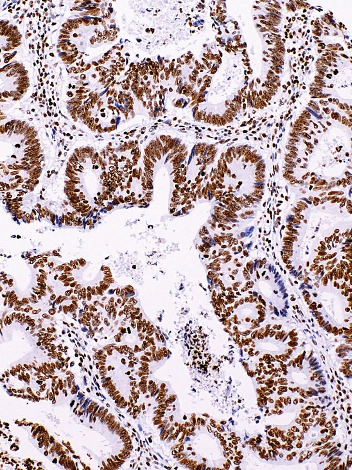 INI-1 Mouse Monoclonal Antibody(ARM512)