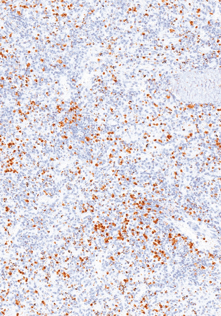 Perforin Mouse Monoclonal Antibody(ARM552)