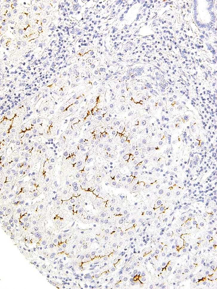 MDR3 Mouse Monoclonal Antibody(ARM524)