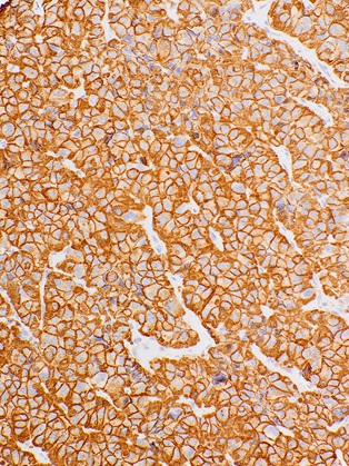 Growth Hormone (GH) Mouse Monoclonal Antibody(ARM502)