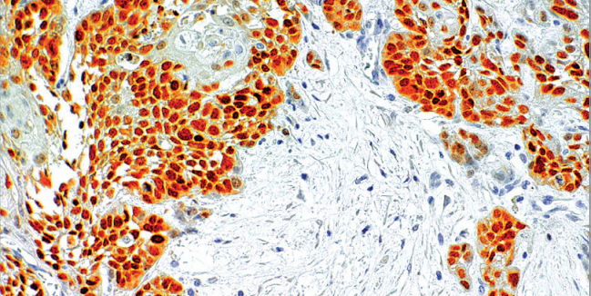 SOX-2 Rabbit Monoclonal Antibody(ARM567)