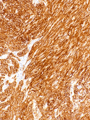 DOG1 Rabbit Monoclonal Antibody(ARM983)