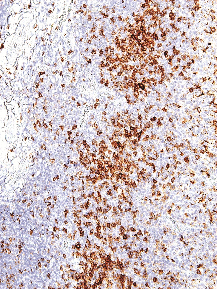 PD-1 Mouse Monoclonal Antibody(ARM549)