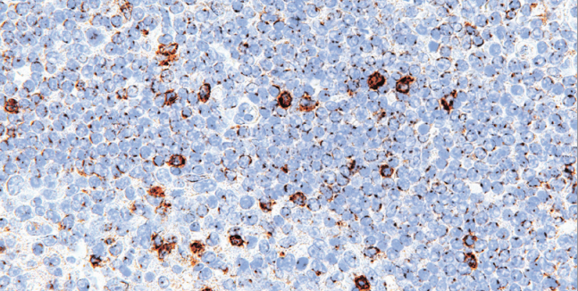 LAG3 Rabbit Monoclonal Antibody(ARM517)