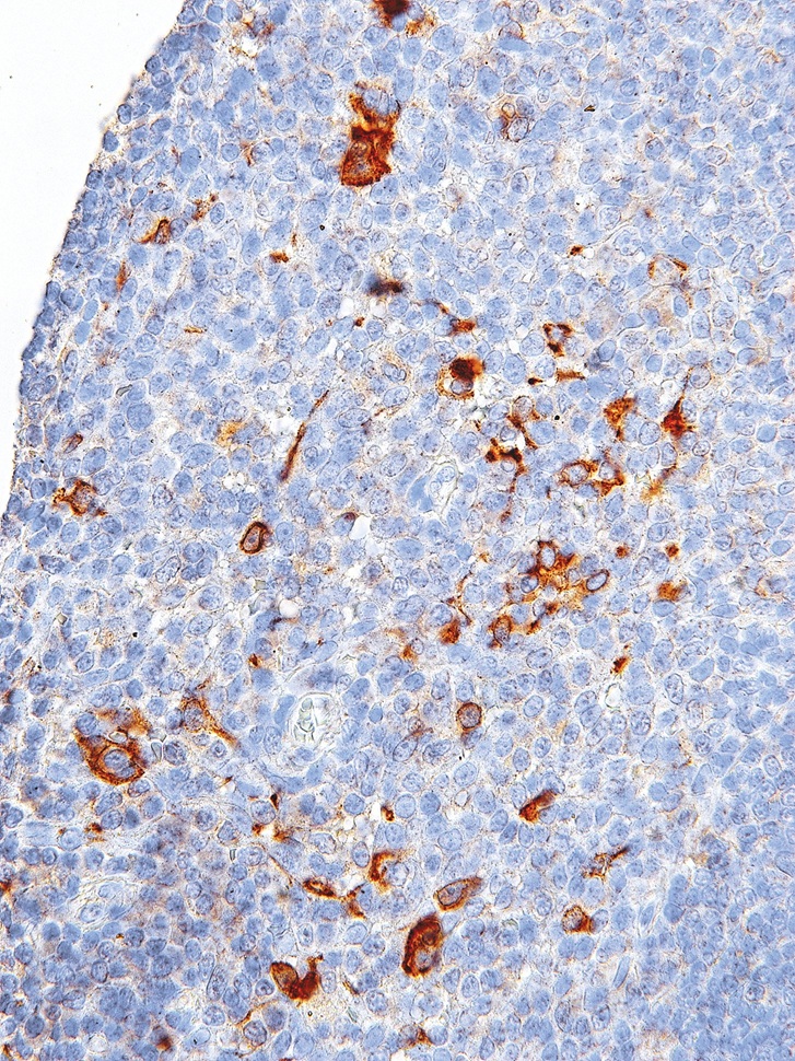 CTLA-4 Rabbit Monoclonal Antibody(ARM971)