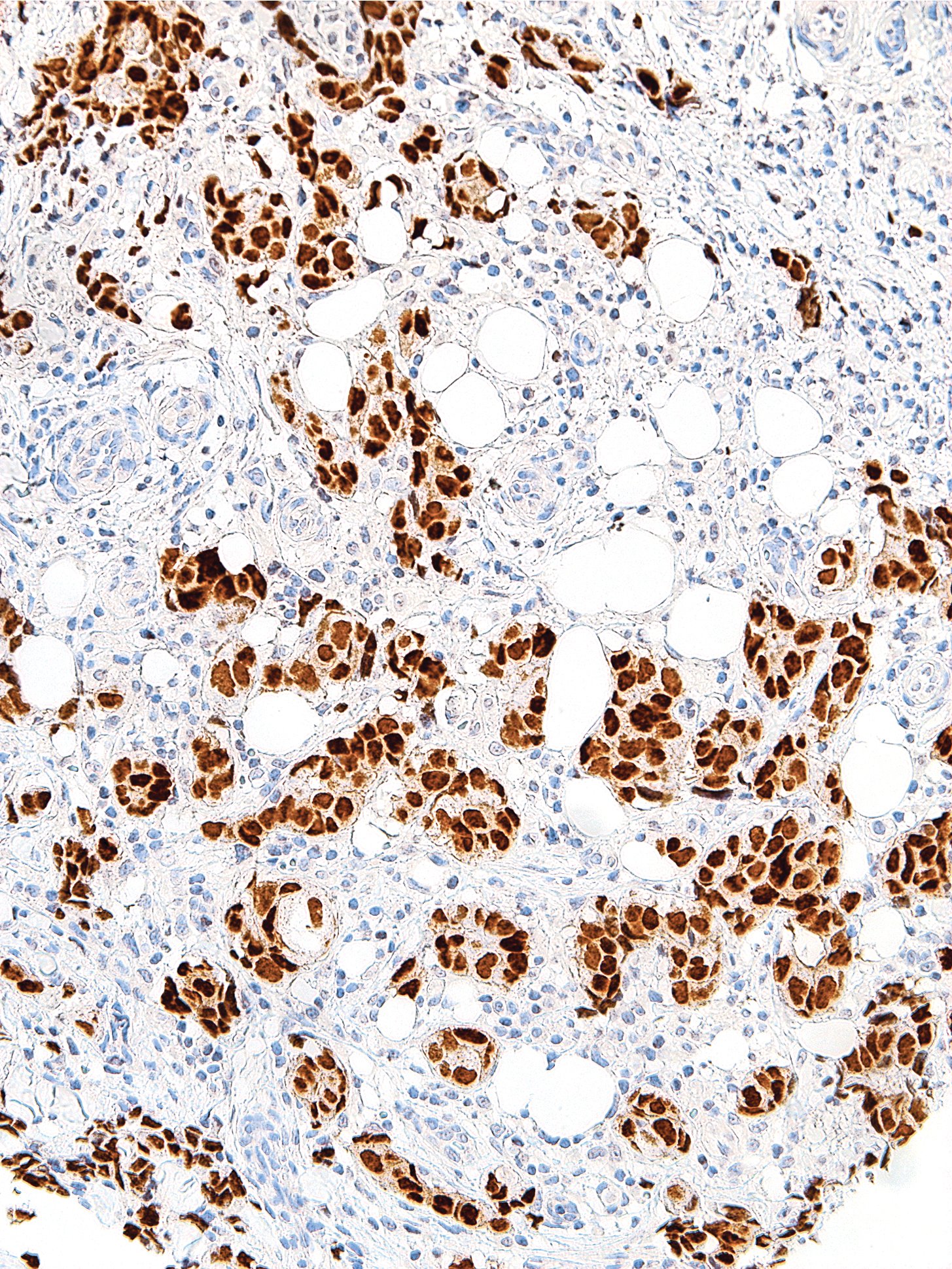 GATA3 Mouse Monoclonal Antibody(ARM995)