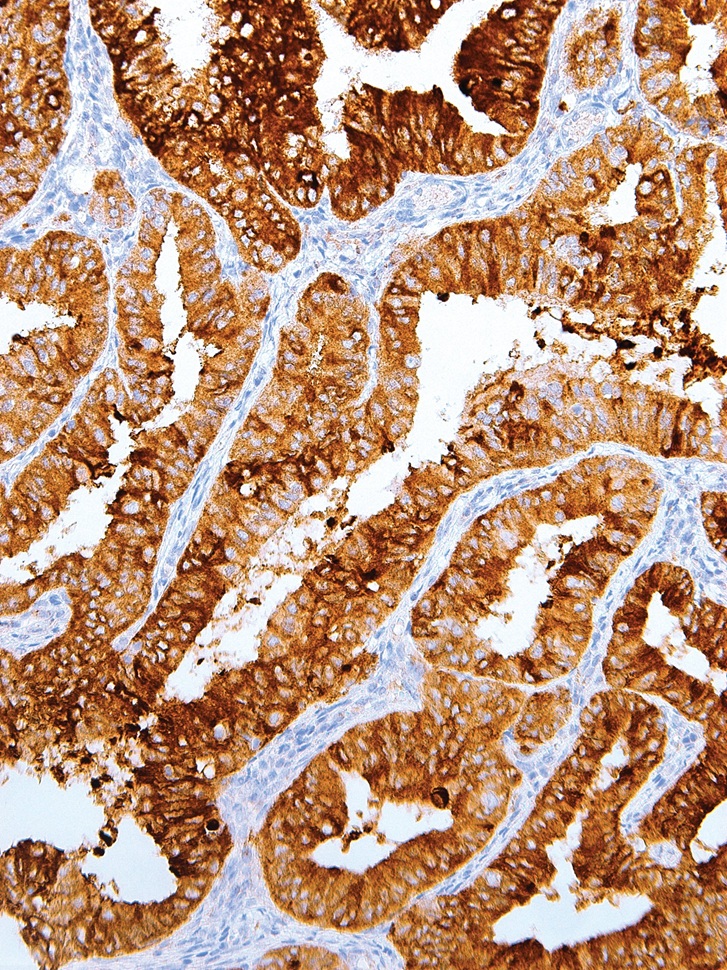 MUC1 Mouse Monoclonal Antibody(ARM528)