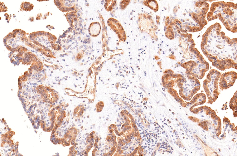 Galectin-3 Mouse Monoclonal Antibody(ARM994)