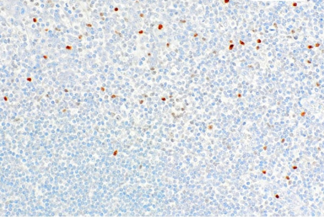 TIA-1 Mouse Monoclonal Antibody(ARM578)