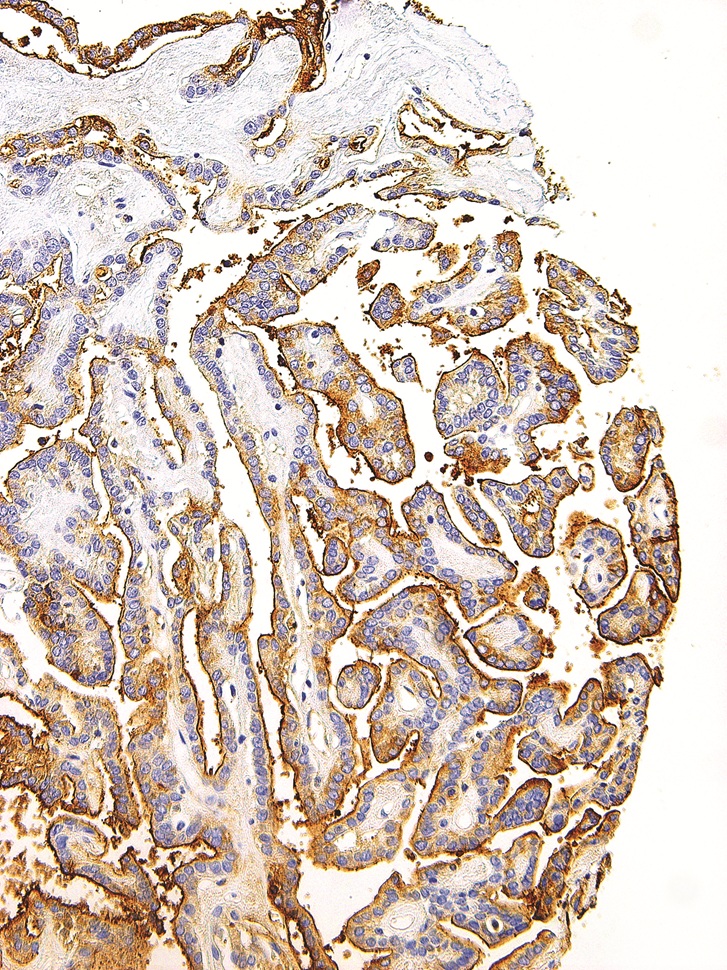 Thyroglobulin Mouse Monoclonal Antibody(ARM577)