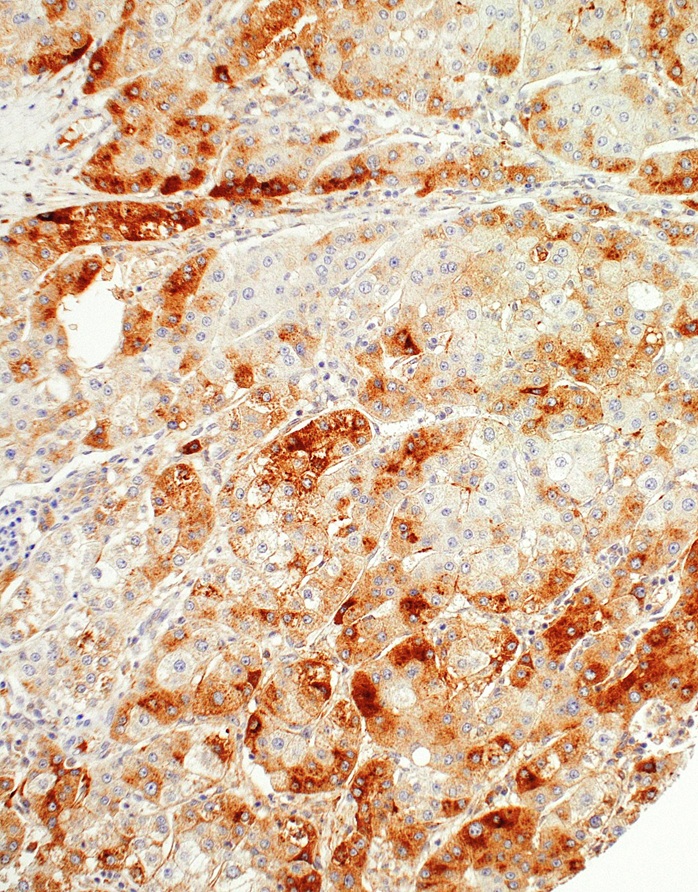 SAA1 Mouse Monoclonal Antibody(ARM562)