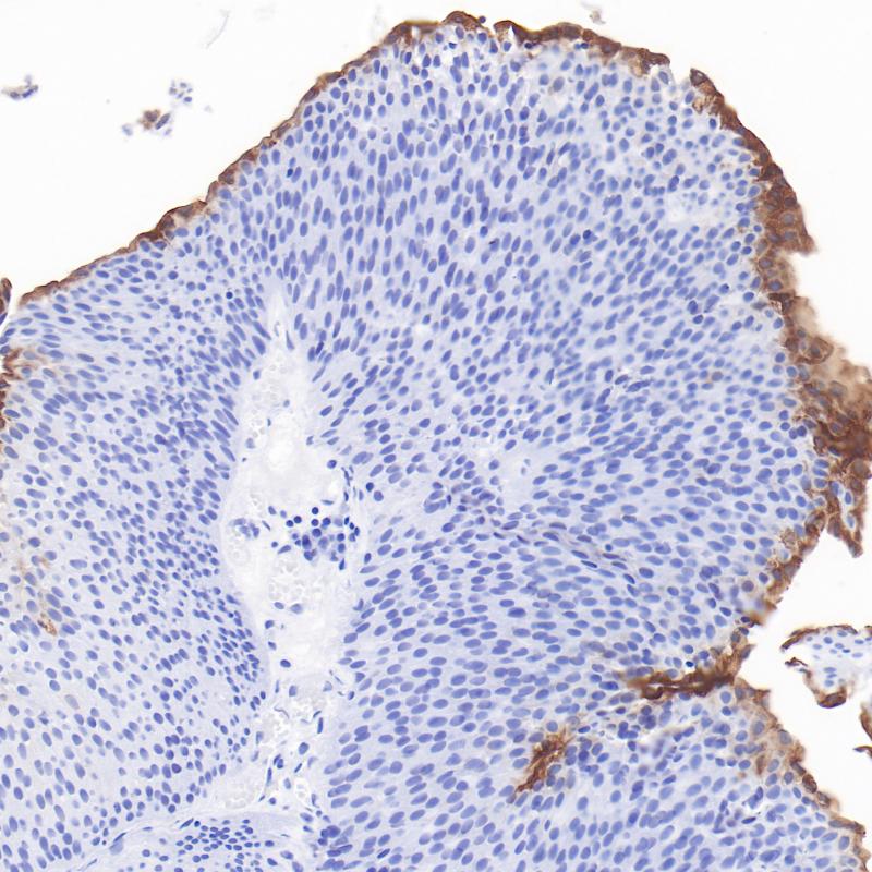 Uroplakin II  Monoclonal Antibody(ARB600)