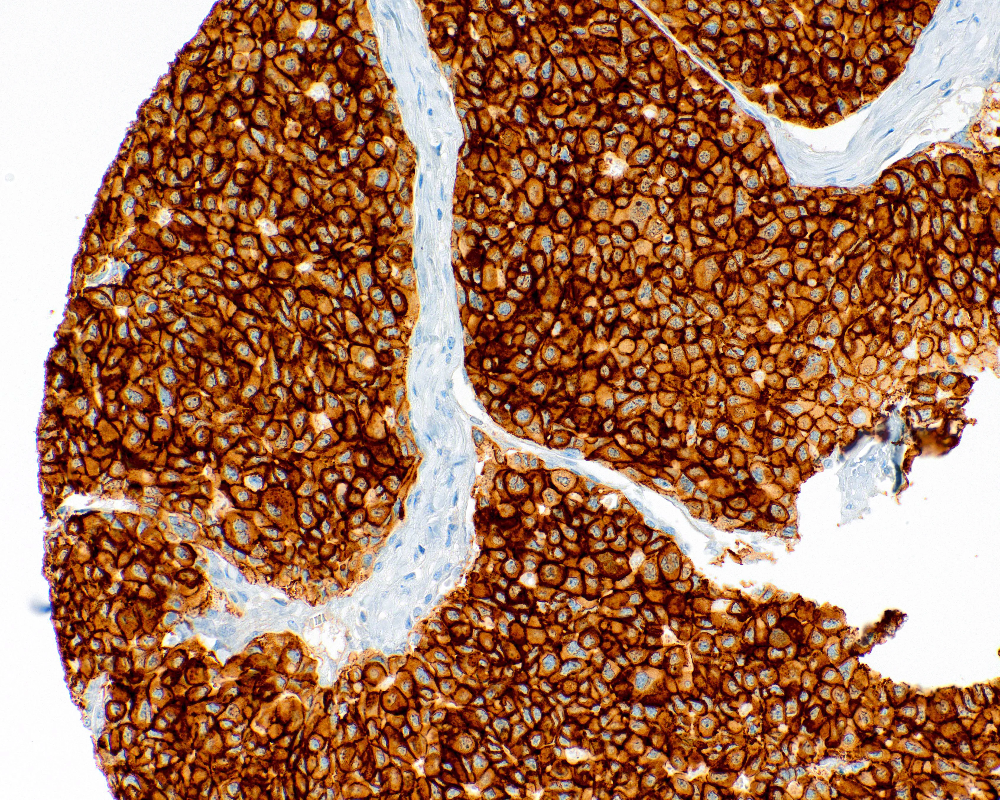 C-Met Rabbit Monoclonal Antibody(ARM587)