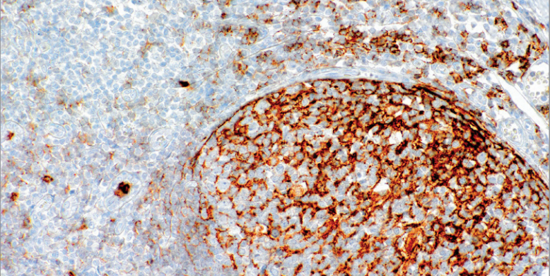 CD35 Rabbit Monoclonal Antibody(ARM606)