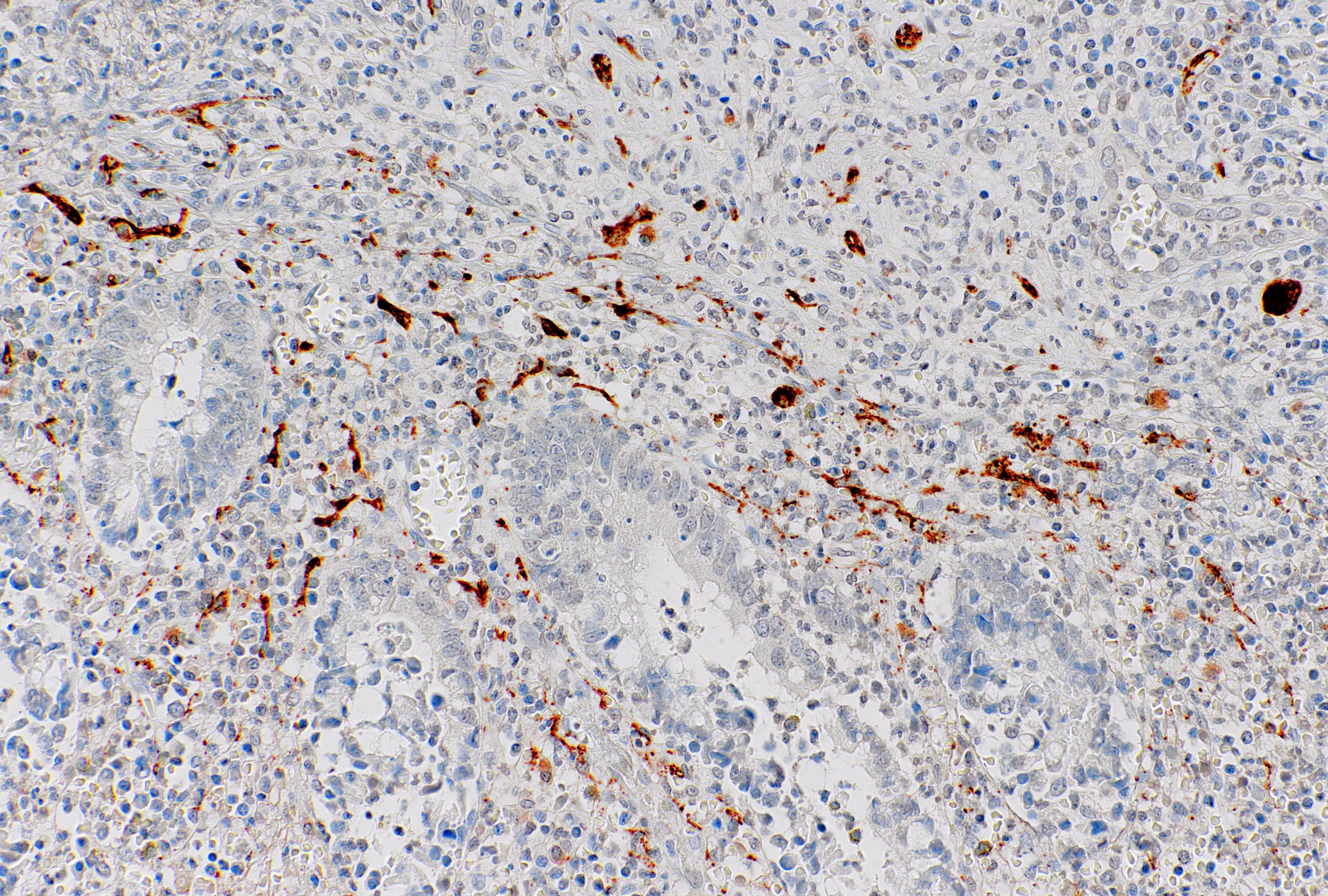 Calretinin Mouse Monoclonal Antibody(ARM601)