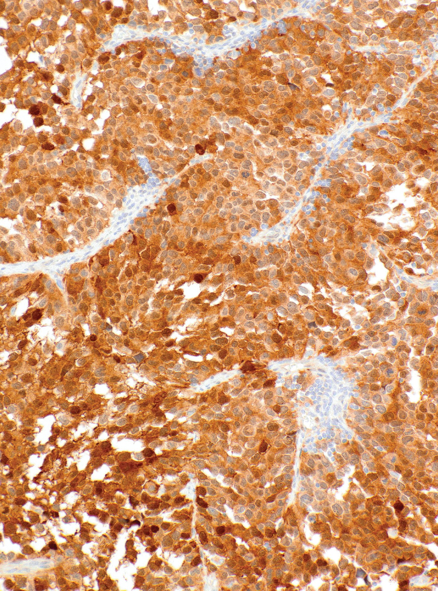 CDK4 Rabbit Monoclonal Antibody(ARM609)